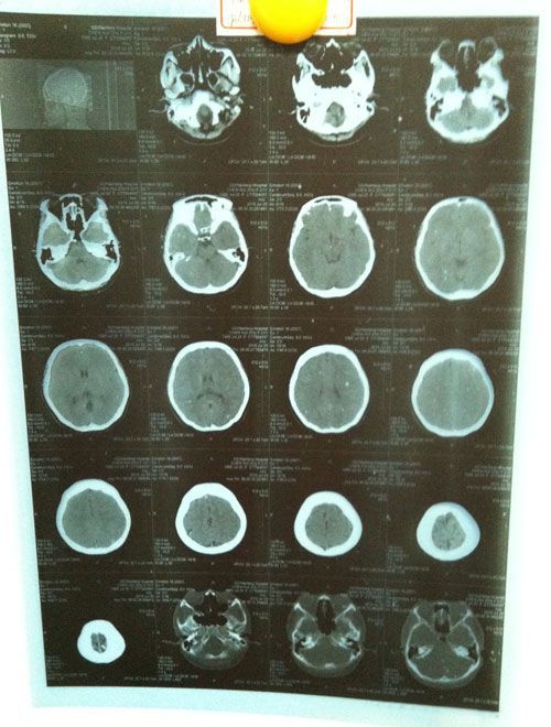 【供应高清医用胶片 x光,dr,ct,mri,petct专用】图片