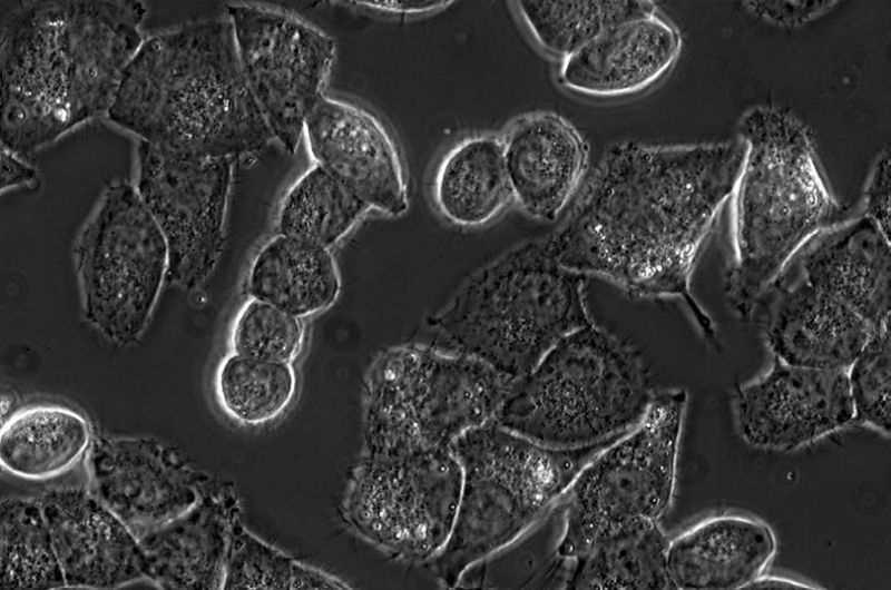 海拉细胞肉块图片