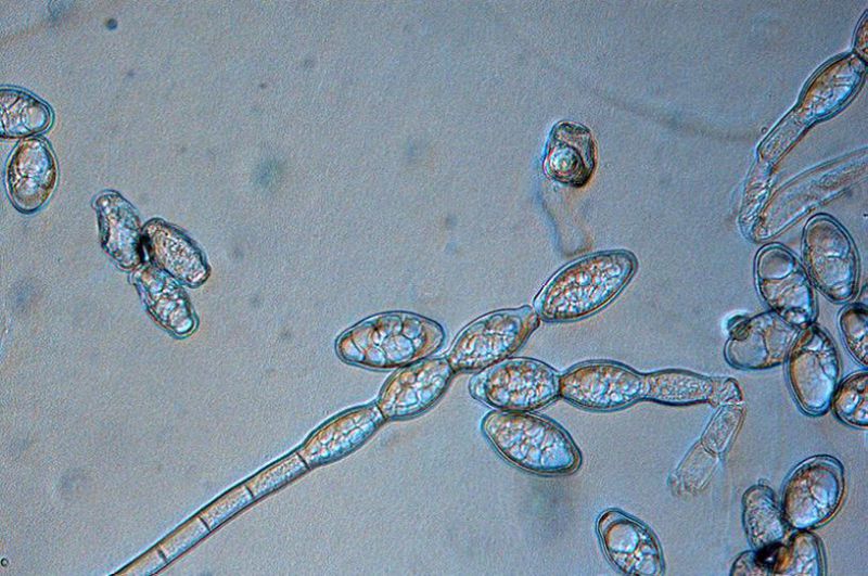 鼠尾草上白粉菌内分生孢子的形成放大倍率:40