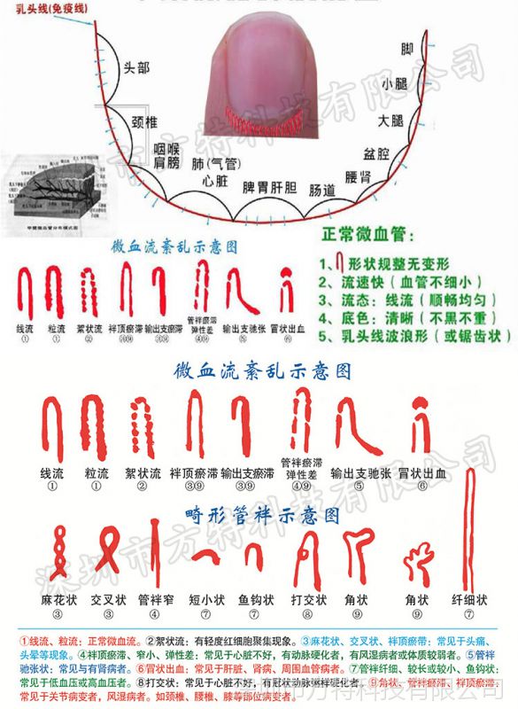 xw880清微循环检测仪末梢血管观察仪养生亚健康检测