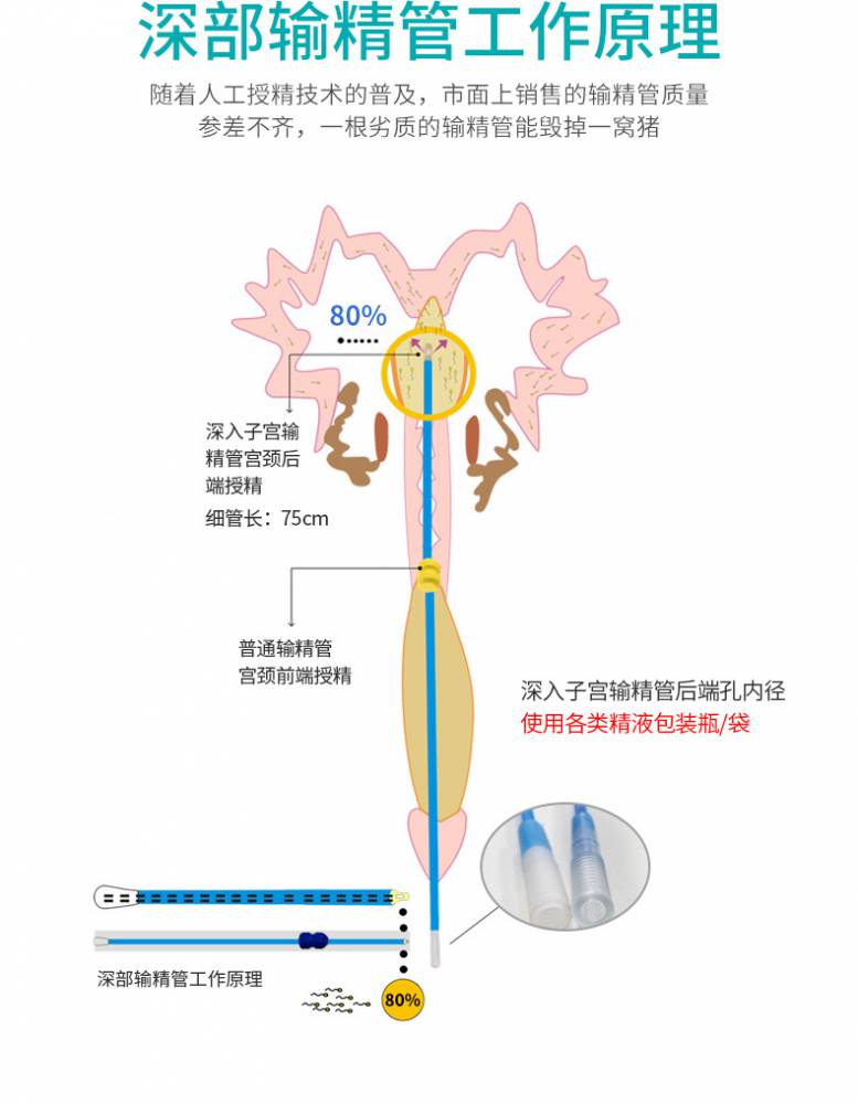 深部输精八步法图片