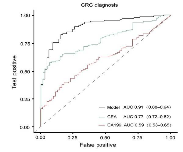 Figure 5. Compar***n of CRC diagnostic performance between the cfDNA methylation model and the tumor biomarker CEA and CA19-9.