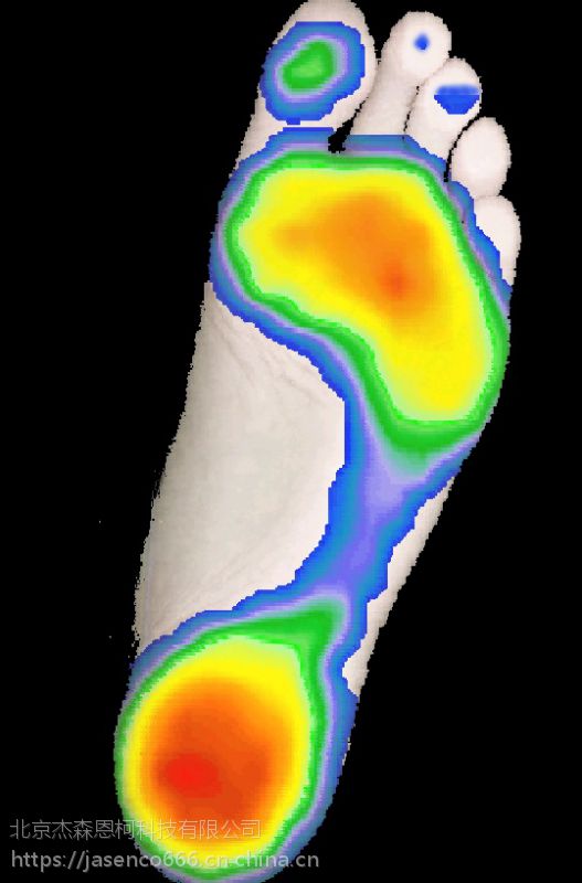 jasenco步态分析足底压力分布测量仪