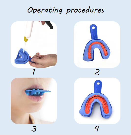 超轻体加成型硅橡胶印模材 牙齿硅橡胶细料印模材 二次印模