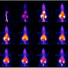 ӦinviscanСӰϵͳIRIS PET/CT