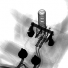 X-RAY﮵عҵCTɨϵͳ/X-ray