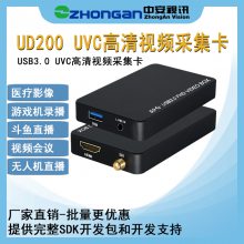 中安视讯UD200 超声工作站软件无驱高清视频图像采集卡游戏录播带混音的高清usb直播采集盒