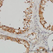  Anti-Anti-PTGS1 antibody produced in rabbit