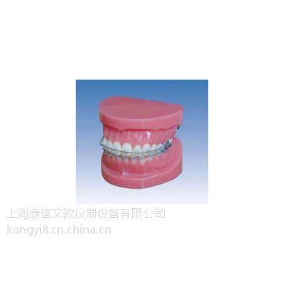 供应康谊牌KY0043固定矫正模型（正常）口腔专科系列模型