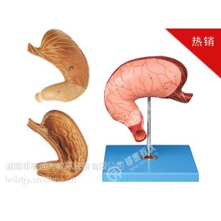 3329胃解剖模型 两部件 生物教学模型 教学仪器