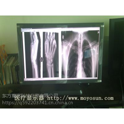 4M医用显示器 台湾MDC(4M)医用显示器