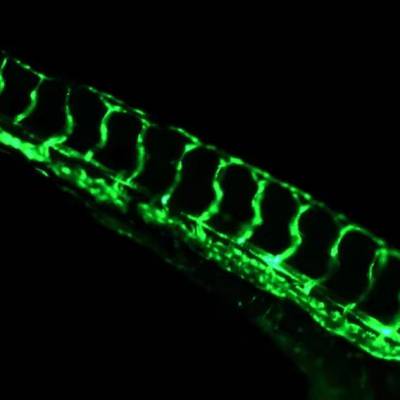 斑马鱼fli-1血管绿色荧光斑马鱼斑马鱼fli-1血管绿色荧光斑马鱼