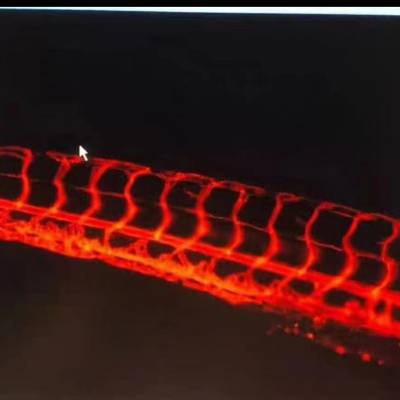 血管红色荧光斑马鱼胚胎幼鱼科研实验斑马鱼