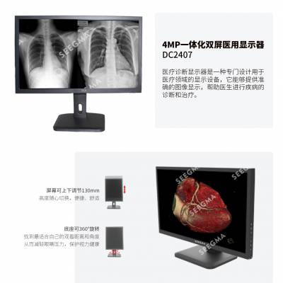 医用显示器找政昆 4M一体化双屏完全符合医疗影像要求