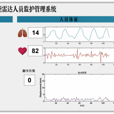 微波呼吸心跳存在感应器微波雷达人体感应模块雷达芯片