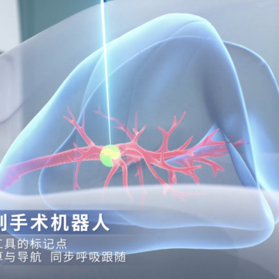 手术器械的未来趋势：光学定位***的生态型机器人产品