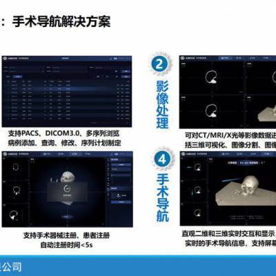 手术导航机器人医学图像处理软件模块 SDK丰富 二次开发