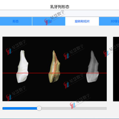 牙科虚拟三维软件 牙科三维仿真实验室