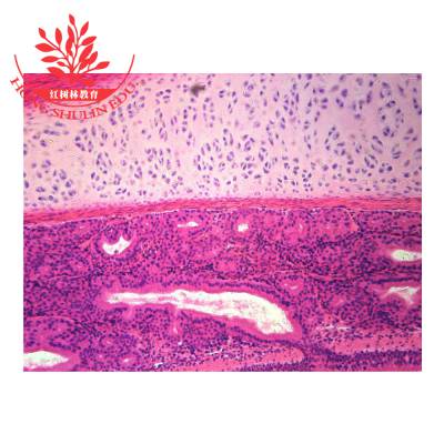 复层柱状上皮光镜图图片