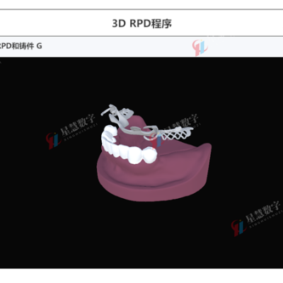 口腔VR实训室 口腔咬合3D软件